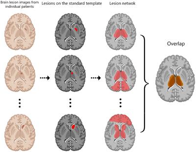 Functional and structural lesion network mapping in neurological and psychiatric disorders: a systematic review